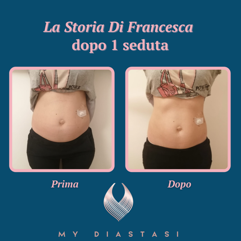 prima e dopo